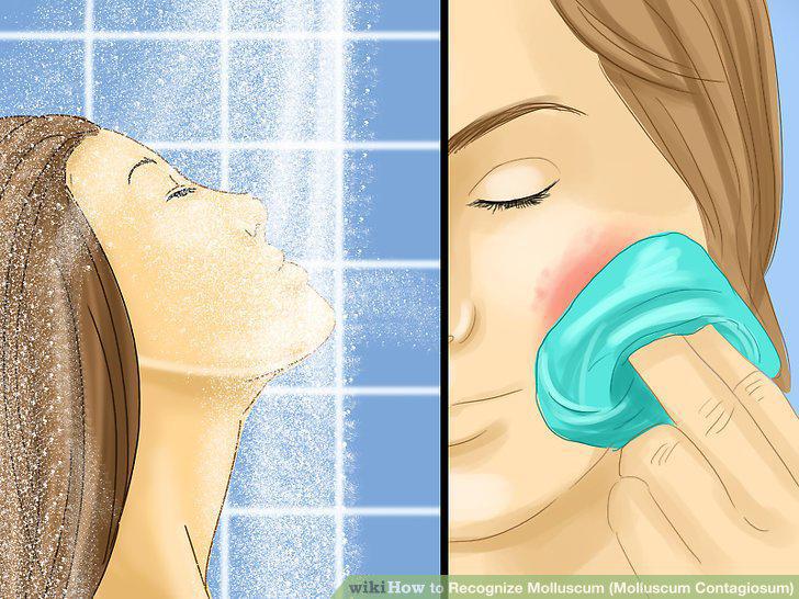 Step 5