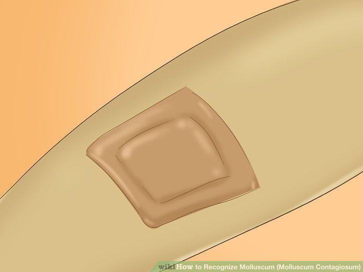 Step 8