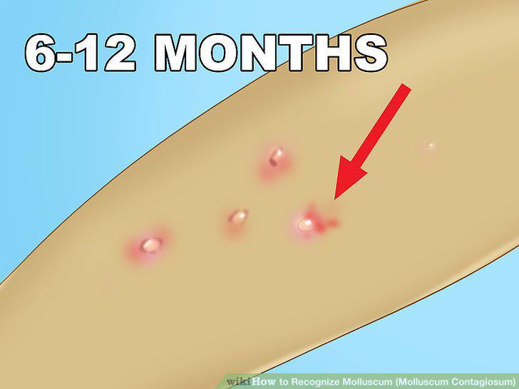 Step 9