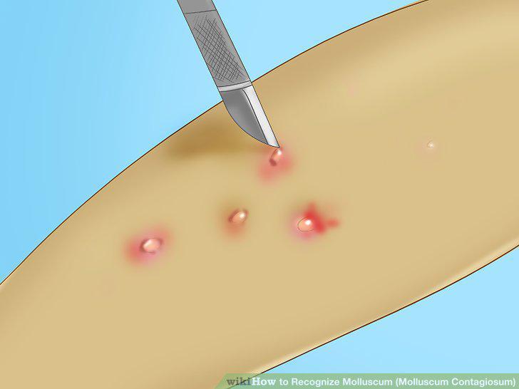 Step 10