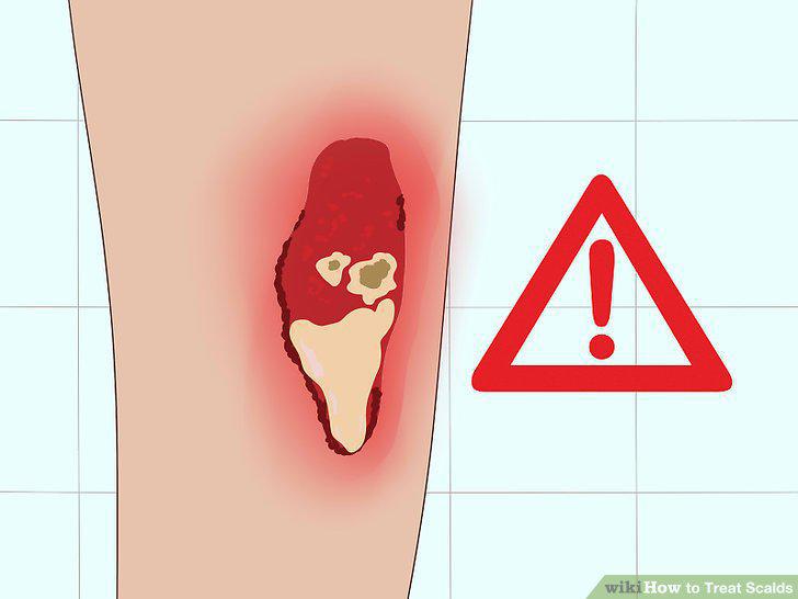 Step 12