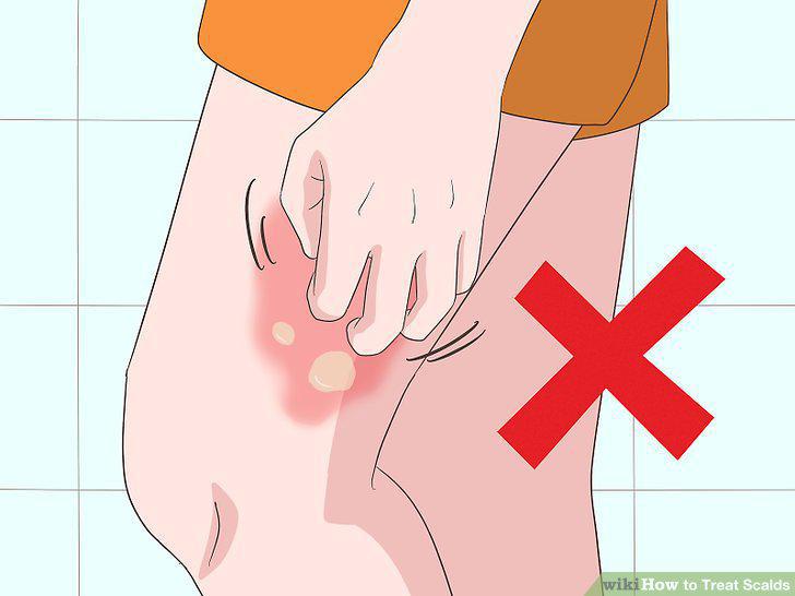 Step 10