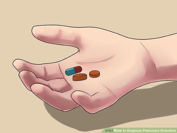 Step 10