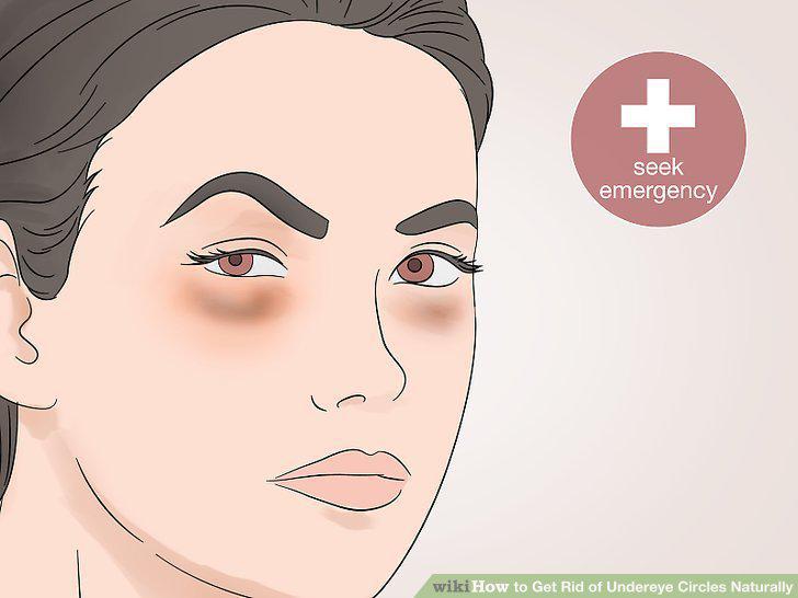 Step 15
