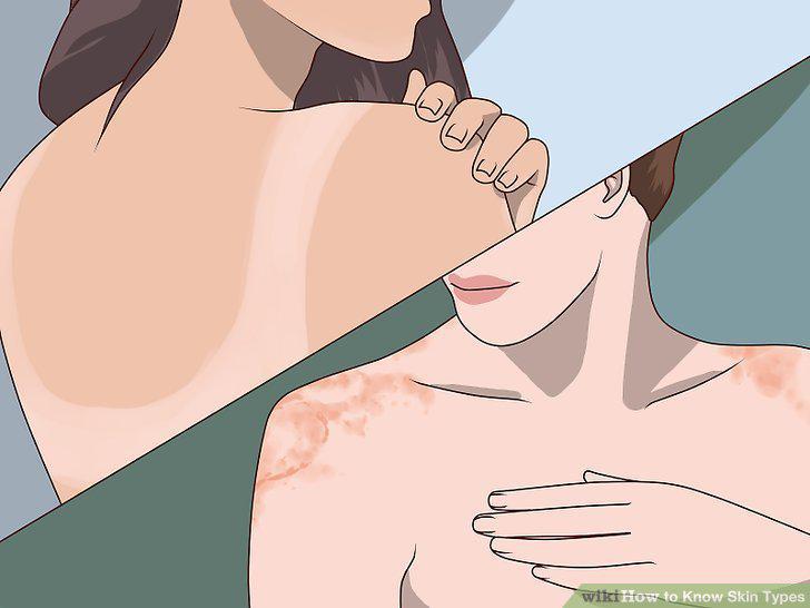 Step 10