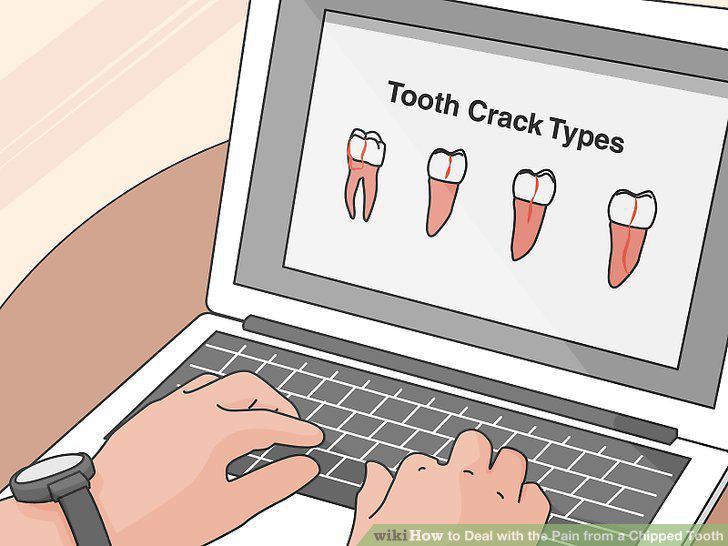 Step 10