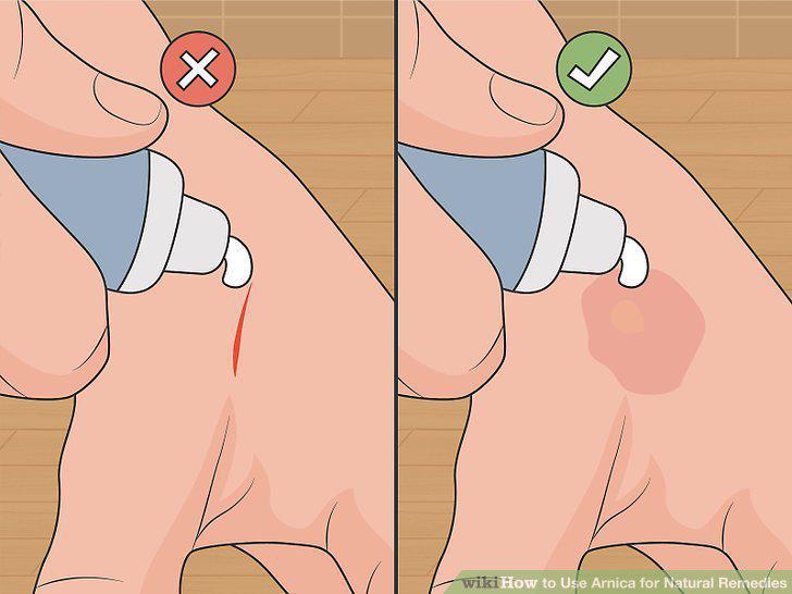 Step 6